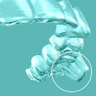 inv-teen_aligner01 inv-teen_aligner01